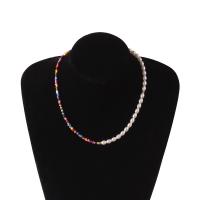 uploads/erp/collection/images/Fashion Jewelry/zuowen/XU0502582/img_b/XU0502582_img_b_2